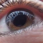 Cornea & Refractive
