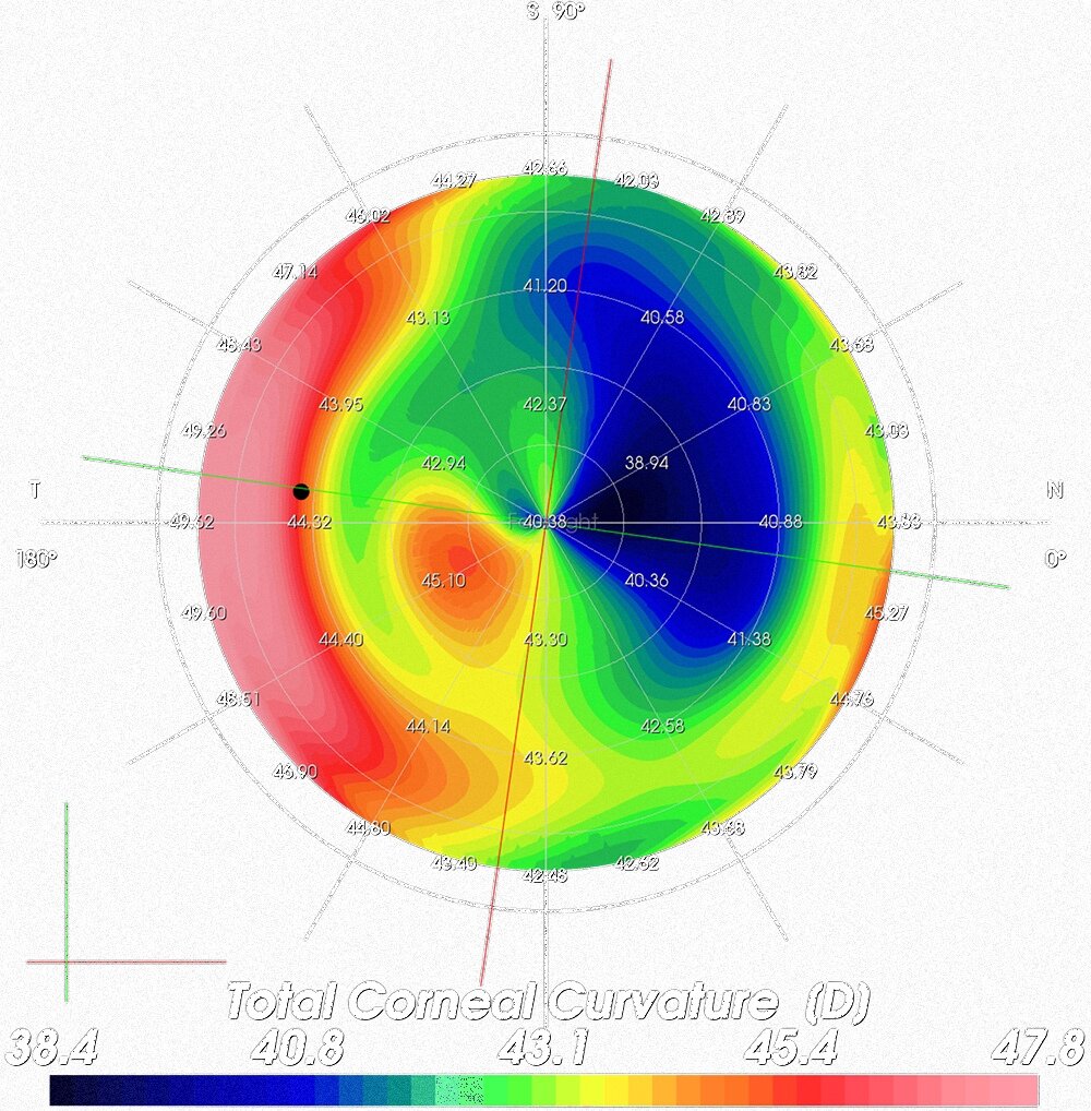 visualisation-preoperative.bcef11a4
